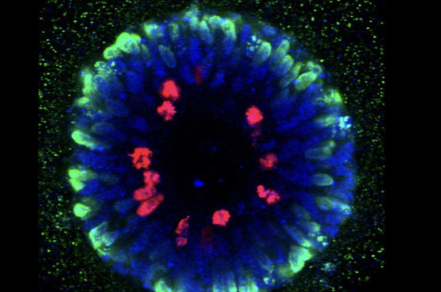 Verband ontdekt tussen genen betrokken bij hersenevolutie en ontwikkelingsstoornissen