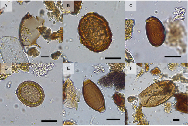 Schistosoma-parasiet ontdekt in middeleeuwse beerput in Brugge