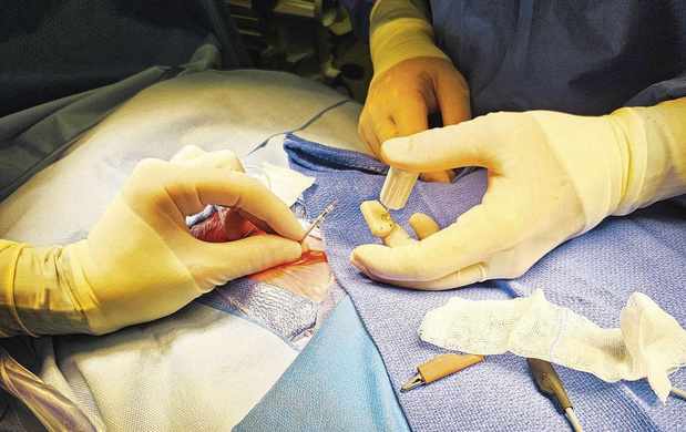 Een pacemaker voor de allerkleinsten 