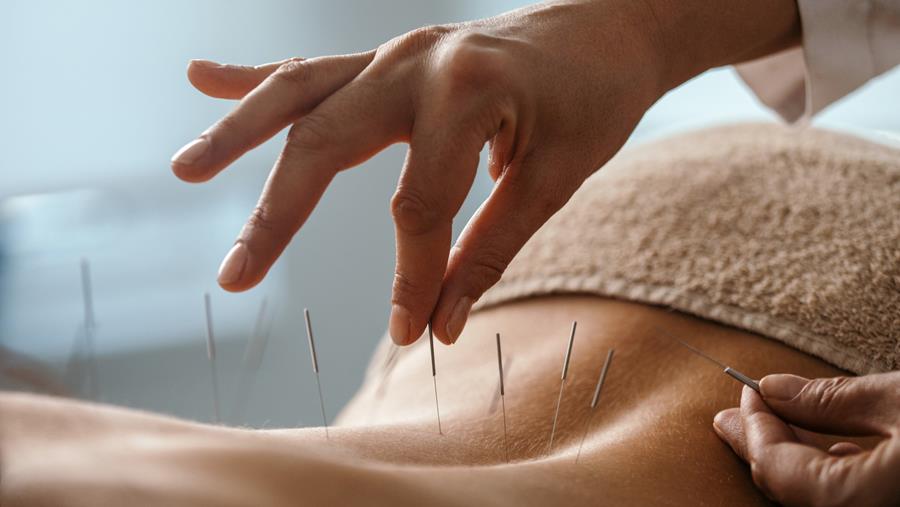 Les acupuncteurs mettent en garde contre les charlatans après la disparition de tout cadre législatif