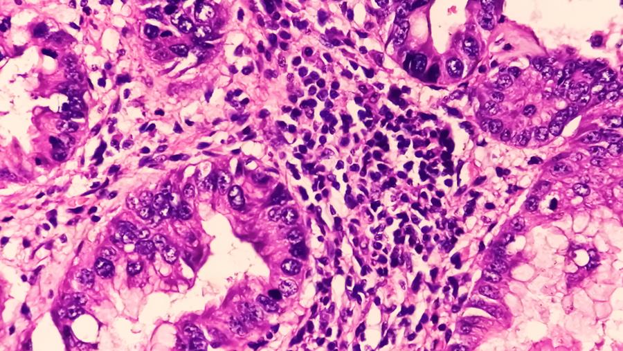 Raffiner le dépistage et le trajet diagnostique