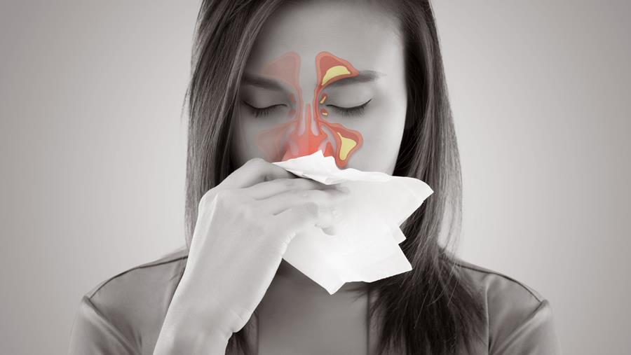 Sinusite aiguë de l’adulte : amoxicilline seule ou avec acide clavulanique ?