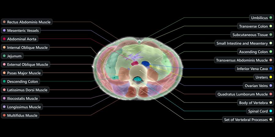 AI-bedrijf Midjourney waagt zich aan medische beeldvorming