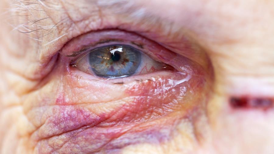 Évaluer les maltraitances : un casse-tête méthodologique