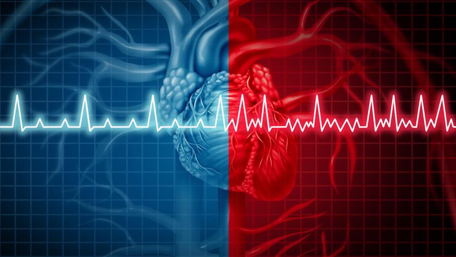 Congrès ESC 2026 : Fibrillation auriculaire à risque intermédiaire d’AVC: anticoaguler ou non ?