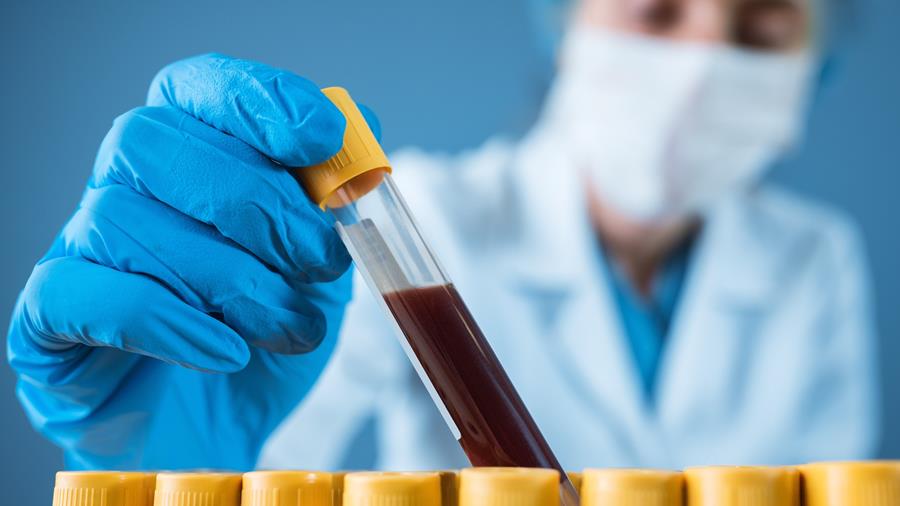 Vlaamse overheid betwijfelt nut bloedonderzoeken naar PFAS