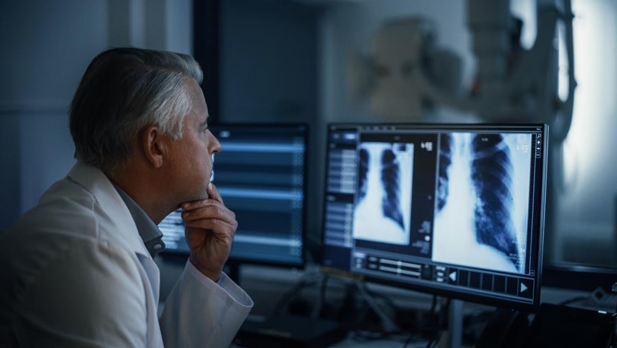 Longkanker: de uitdaging van een vroege diagnose